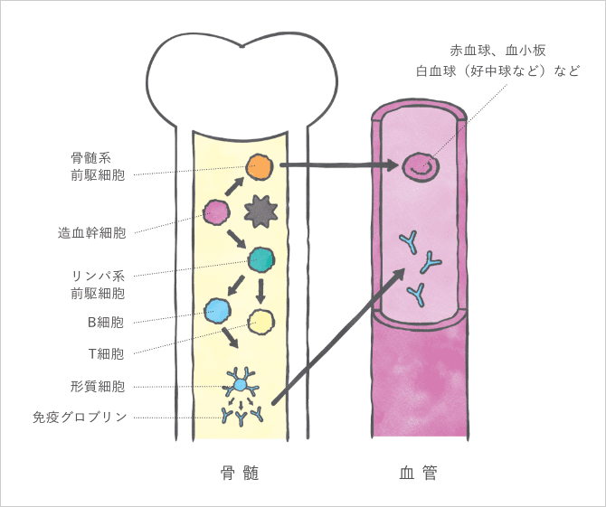 「全身性免疫グロブリン軽鎖(AL)アミロイドーシスの原因は?」の説明画像