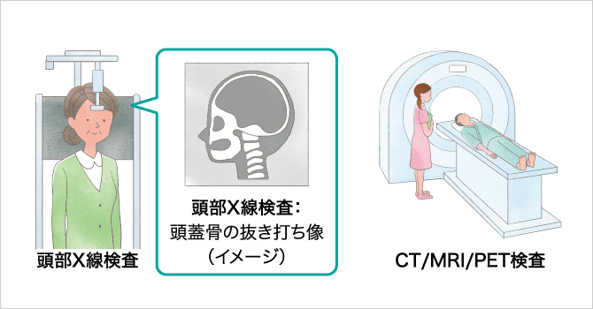 「画像検査(レントゲン、CT、MRIなど)」の説明画像
