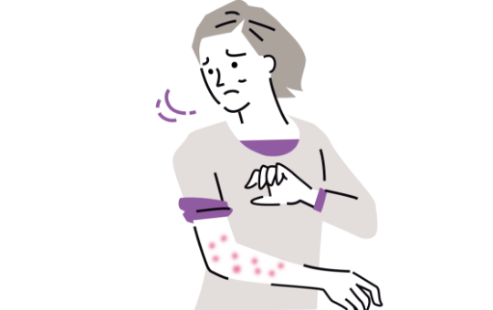 皮膚のかゆみ、じんましん、皮疹（発疹）