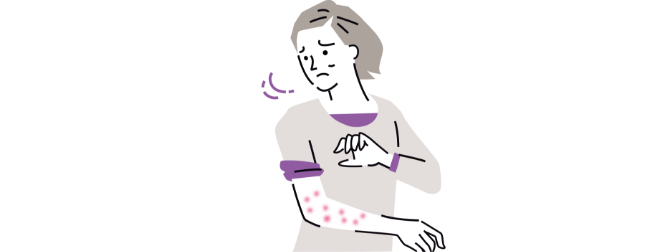 皮膚のかゆみ、じんましん、皮疹（発疹）